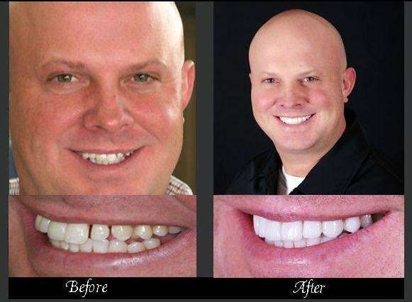 Kluth Family & Cosmetic Dentistry, Inc. | 16000 Prosperity Dr suite 400, Noblesville, IN 46060 | Phone: (317) 770-1050