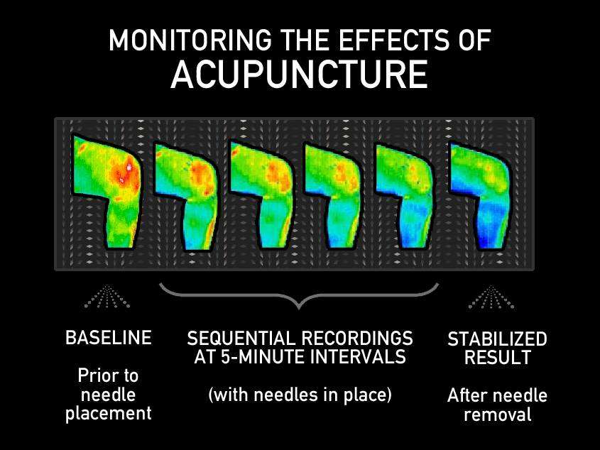 Thermography of Indianapolis | 210 E 91st St suite b, Indianapolis, IN 46240 | Phone: (317) 370-5111