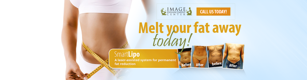 Smart Liposuction Houston | Houstons SmartLipo Experts | 6363 Woodway Dr Suite A-850, Houston, TX 77057, USA | Phone: (832) 429-2171