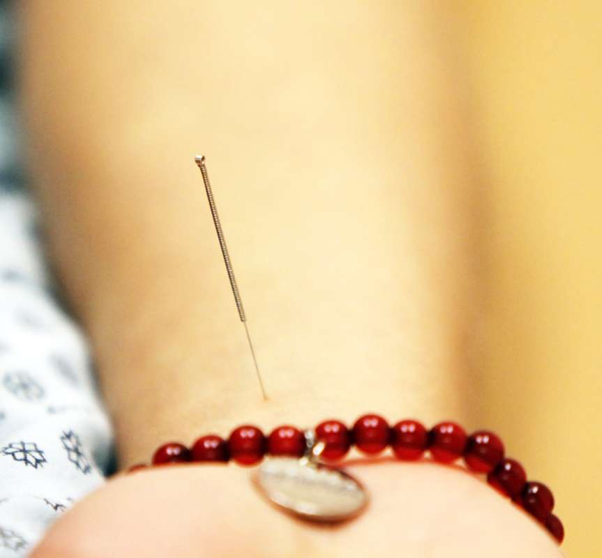 Little Acupuncture | 1601 Town Center Blvd, Weston, FL 33326, USA | Phone: (954) 349-6551