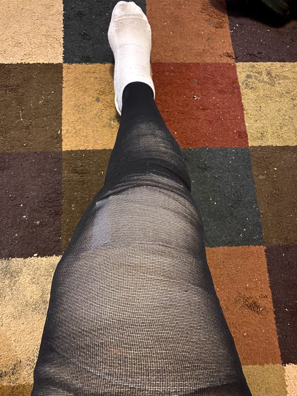 Metro Vein Centers | 385 Prospect Ave Suite 316, Hackensack, NJ 07601, USA | Phone: (201) 581-0773