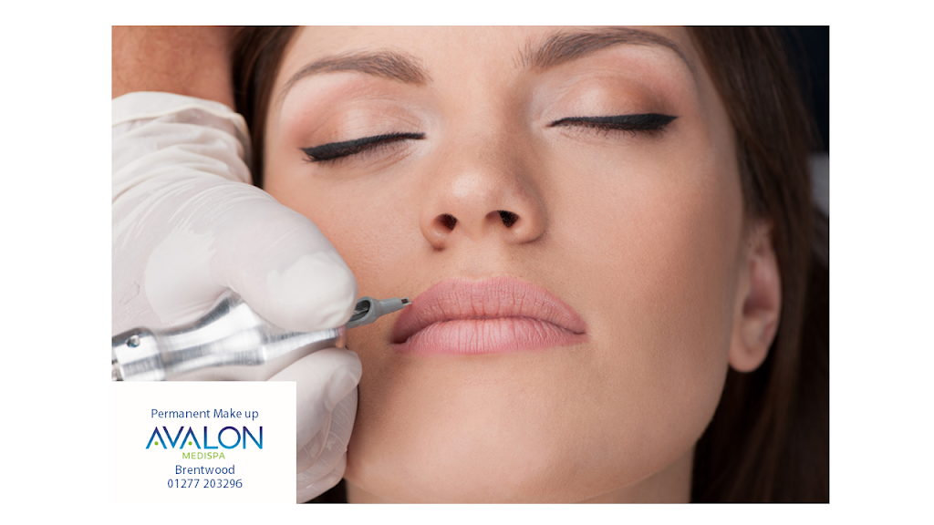 Avalon Medispa | 53 Goodwood Ave, Brentwood CM13 1QD, UK | Phone: 01277 203296