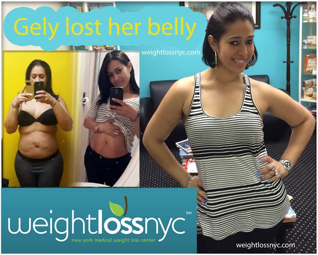 Dr. Aron Medical Weight Loss Center, WeightLossNYC | 7032 4th Ave, Brooklyn, NY 11209, USA | Phone: (718) 491-5525