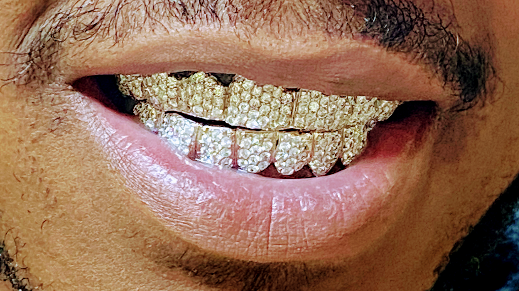 Mesa Gold Grillz LLC | 1731 W Baseline Rd #112, Mesa, AZ 85202, USA | Phone: (855) 290-4653