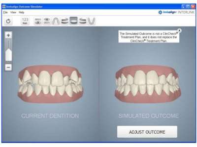 Tipton Park Dentistry | 530 Plaza Dr J, Columbus, IN 47201 | Phone: (812) 376-9335