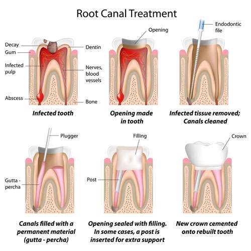 The Dental Method Richardson | 610 Old Campbell Rd #116, Richardson, TX 75080, USA | Phone: (972) 231-2576