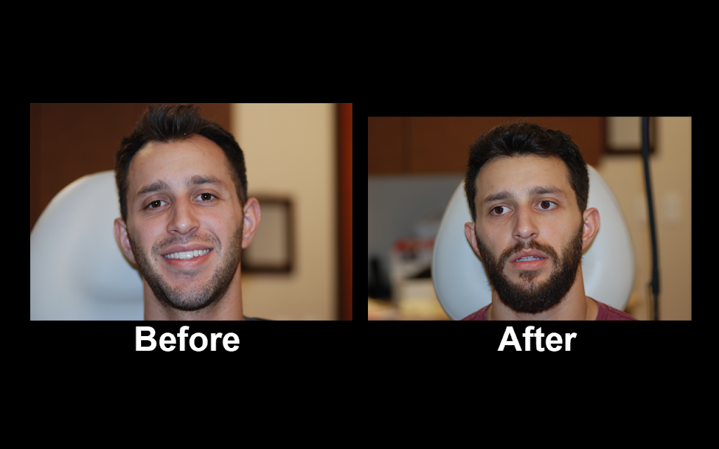 Halby Hair Transplant, Ltd. | 5524 S Fort Apache Rd Suite #100, Las Vegas, NV 89148, USA | Phone: (702) 258-6229