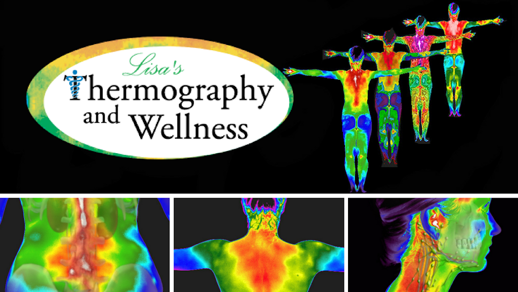 Lisas Thermography and Wellness Lincoln Park, NJ | 63 Beaverbrook Rd Suite 105, Lincoln Park, NJ 07035 | Phone: (855) 667-9338