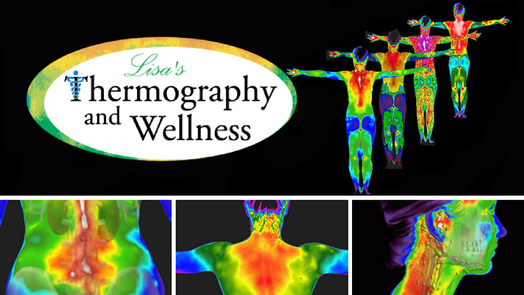 Lisas Thermography and Wellness Lincoln Park, NJ | 63 Beaverbrook Rd Suite 105, Lincoln Park, NJ 07035, USA | Phone: (855) 667-9338