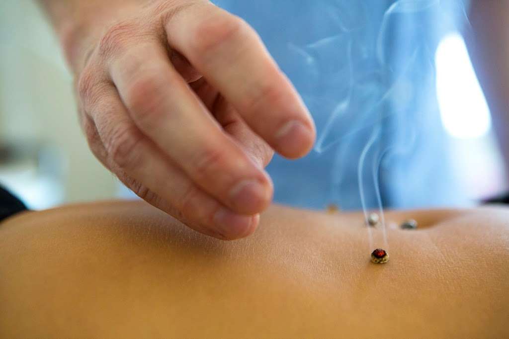 Bruce McCallum Acupuncture | London Natural Health Centre, 46 Theobalds Road, London WC1X 8NW, UK | Phone: 07719 390857