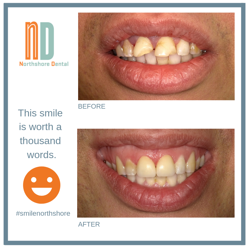 Northshore Dental | 2 Evanston St, Houston, TX 77015, USA | Phone: (713) 453-7466
