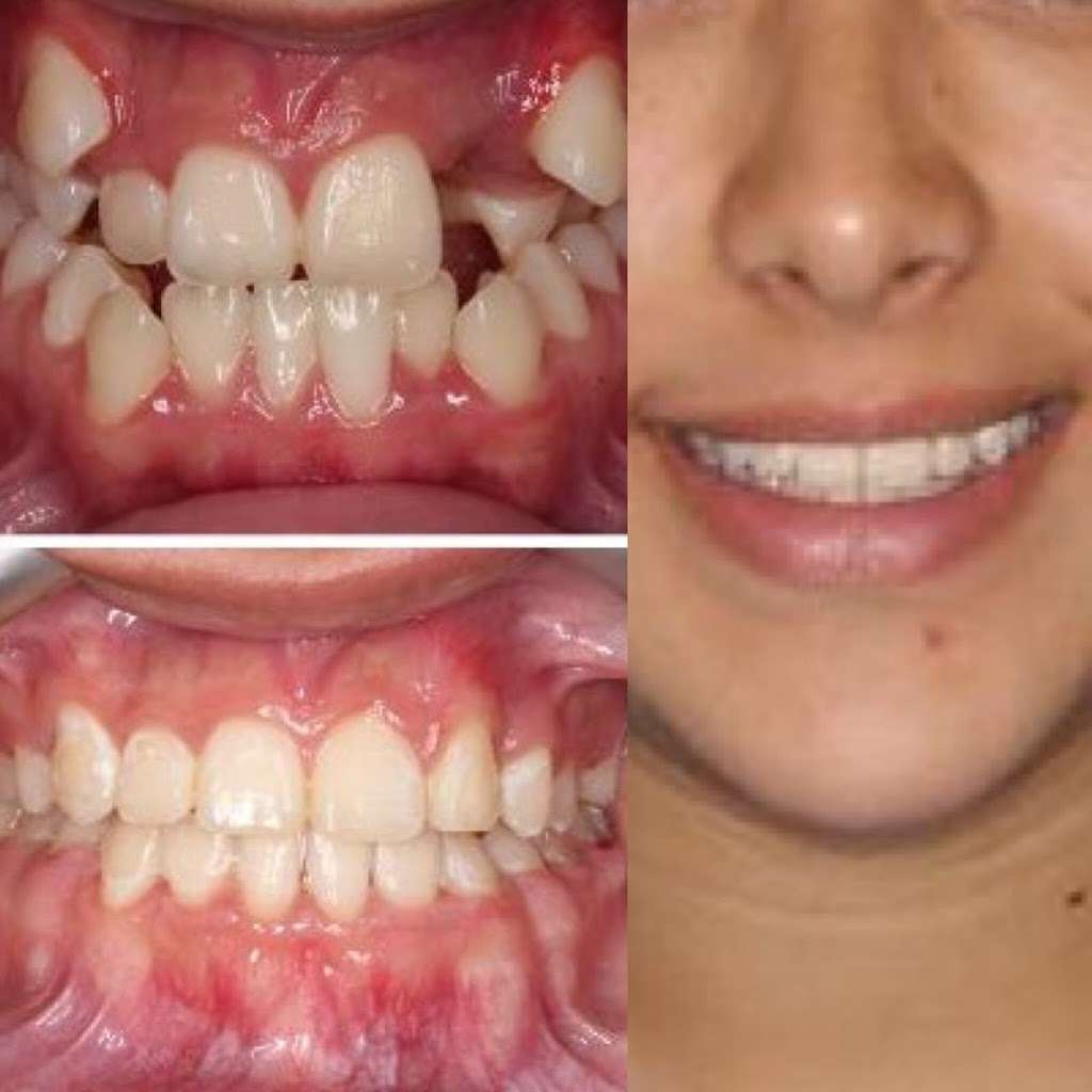 CURTIS ORTHODONTICS | 2963 W Elliot Rd #1, Chandler, AZ 85224, USA | Phone: (480) 838-7410