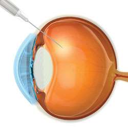 Connecticut Retina Consulants | 4920 Main St #309, Bridgeport, CT 06606 | Phone: (203) 365-6565