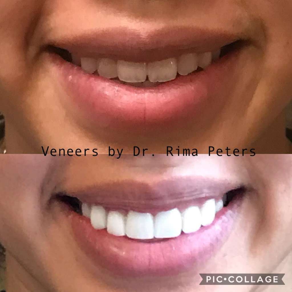 Warner Village Cosmetic & Family Dentistry | 8675 S Priest Dr, Tempe, AZ 85284, USA | Phone: (480) 961-0600