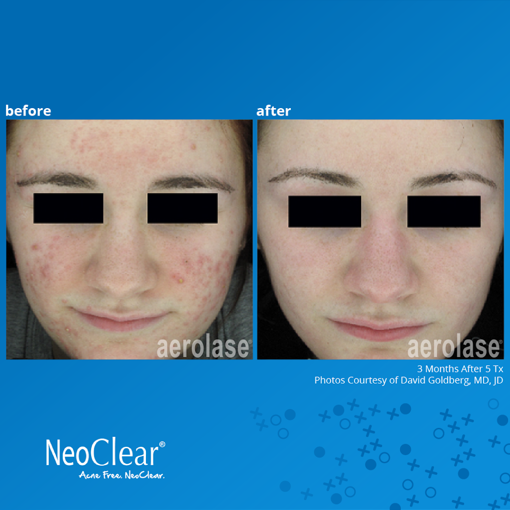 Clarity Acne & Aesthetic Dermatology | 3345 Bridge Rd Ste 900, Suffolk, VA 23435, USA | Phone: (757) 250-7986