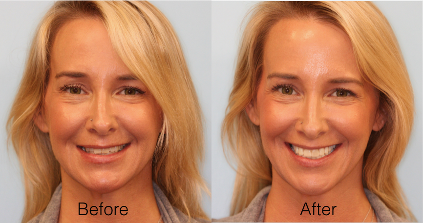 Shawn OBerry DDS | 33493 Del Obispo St, Dana Point, CA 92629, USA | Phone: (949) 496-6413