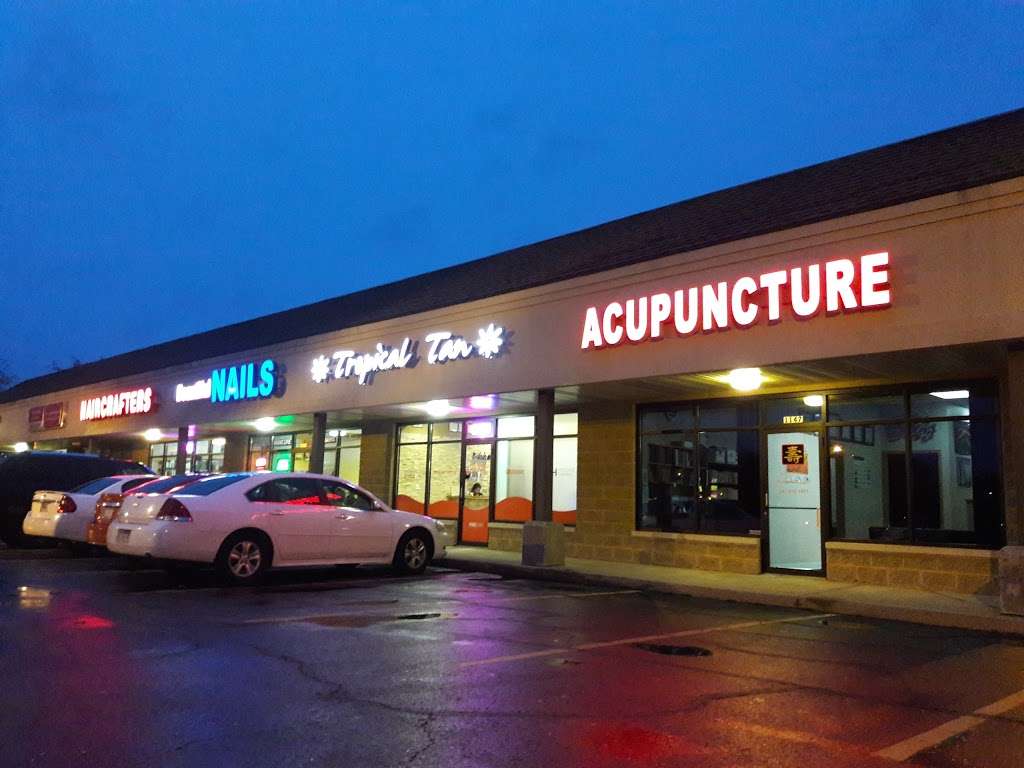 Longevity Acupuncture LLC | 1147 N Green Bay Rd, Waukegan, IL 60085, USA | Phone: (847) 672-4801