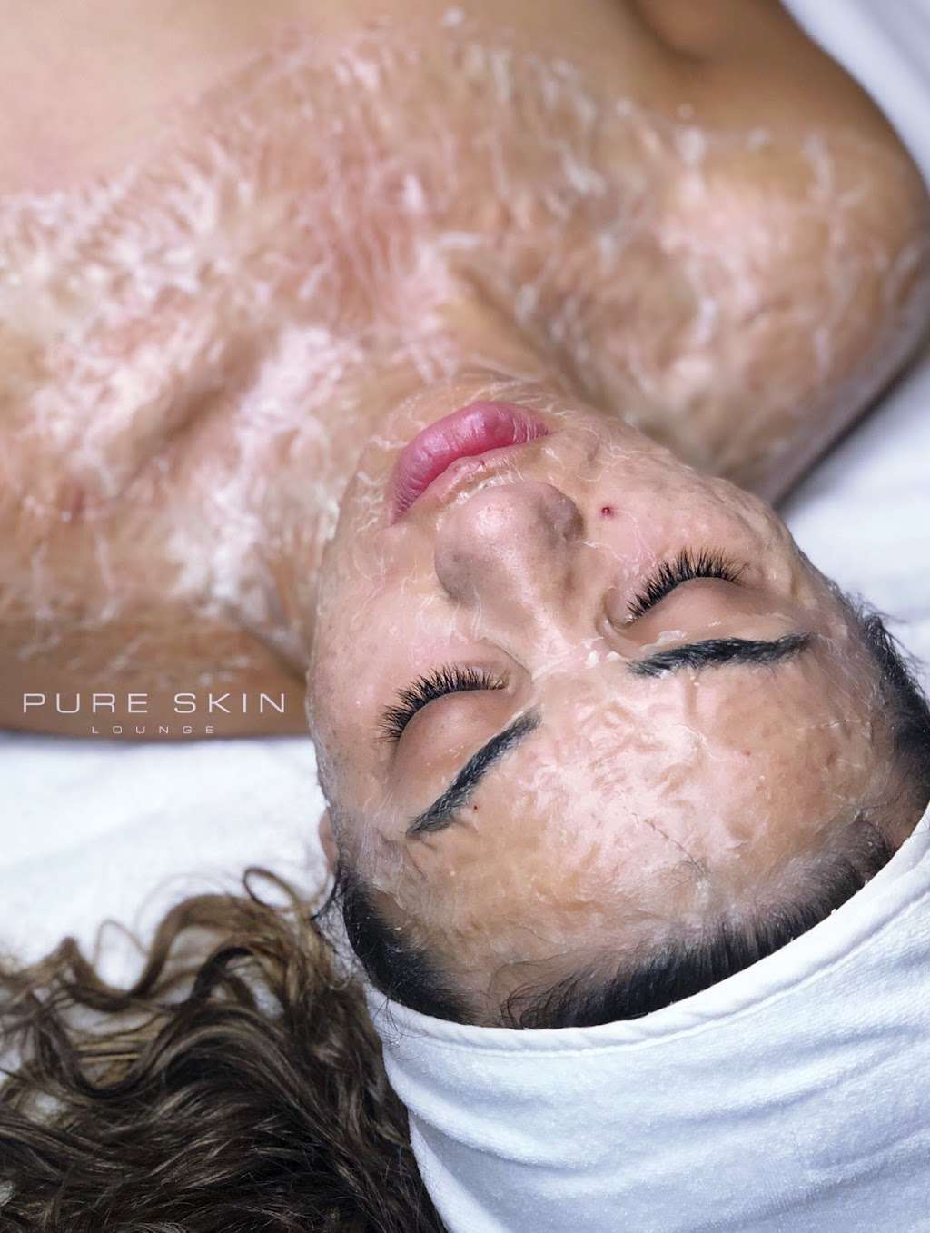 Pure Skin Lounge | 1425 University Ave Ste B, San Diego, CA 92103, USA | Phone: (619) 354-6826