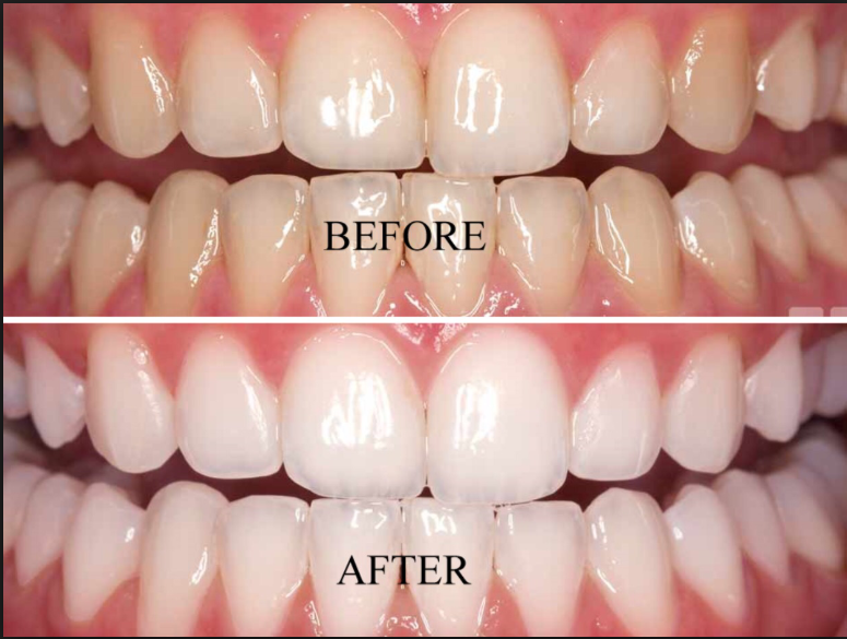 Bucks Dental Associates | 4 Meadowbrook Ln, Chalfont, PA 18914, USA | Phone: (215) 997-5550