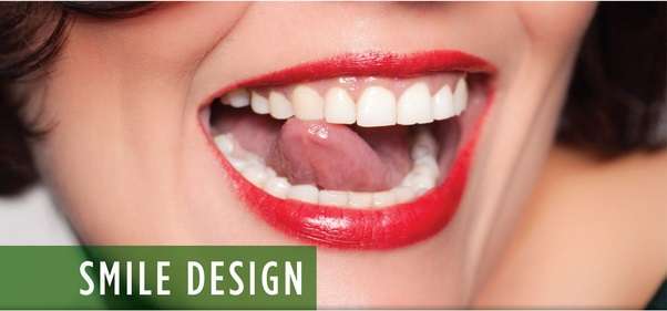 Katharine Jones DDS, Fabulous Smiles Dental Center | 2100 Carlmont Dr #1, Belmont, CA 94002, USA | Phone: (650) 595-0913