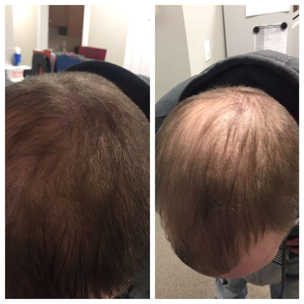 Dr. Happe Medical Aesthetics, LLC | 15 Homestead St, Waban, MA 02468, USA | Phone: (617) 597-2600 Dr. Happe Medical Aesthetics, LLC | 15 Homestead St, Waban, MA 02468, USA | Phone: (617) 597-2600