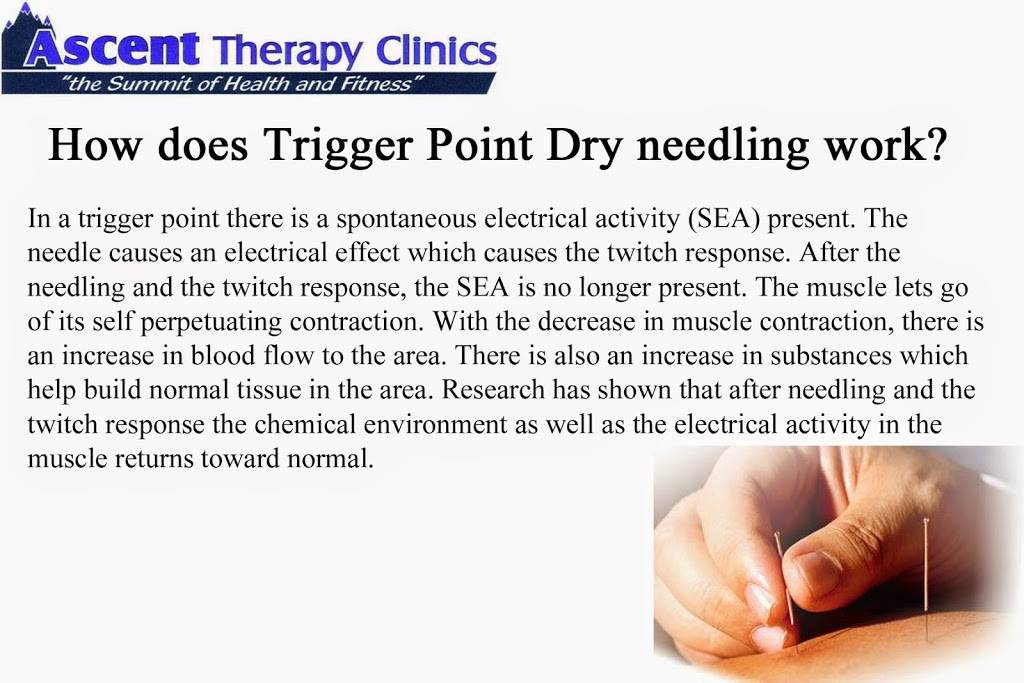 Ascent Therapy Clinic | 9116 W Bowles Ave #10, Littleton, CO 80123, USA | Phone: (303) 978-9200