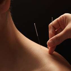 Chinese Acupuncture & Oriental Medicine Center | 5330 Manhattan Cir, Boulder, CO 80303, USA | Phone: (720) 383-8548