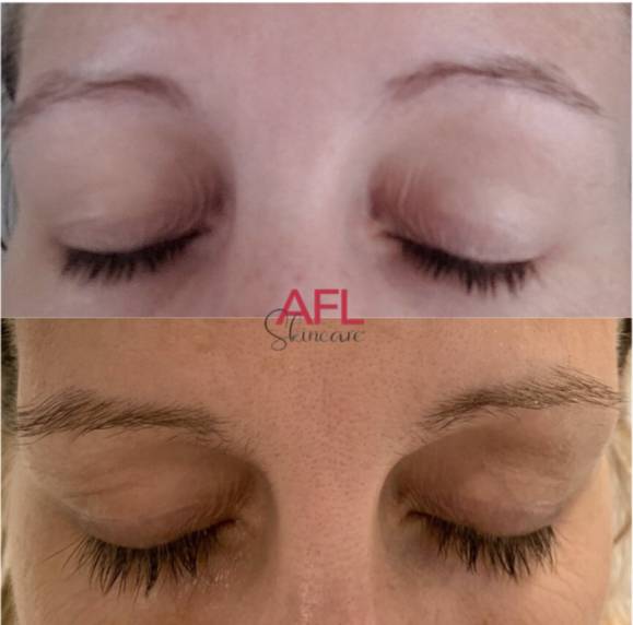 AFL Skincare | 2934 W 66th St Suite 9, Edina, MN 55423, USA | Phone: (612) 394-1752