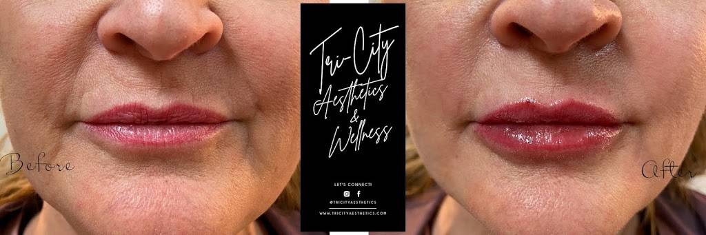 Tri-City Aesthetics & Wellness | 8413 E Baseline Rd STE 106, Mesa, AZ 85209, USA | Phone: (480) 648-0226