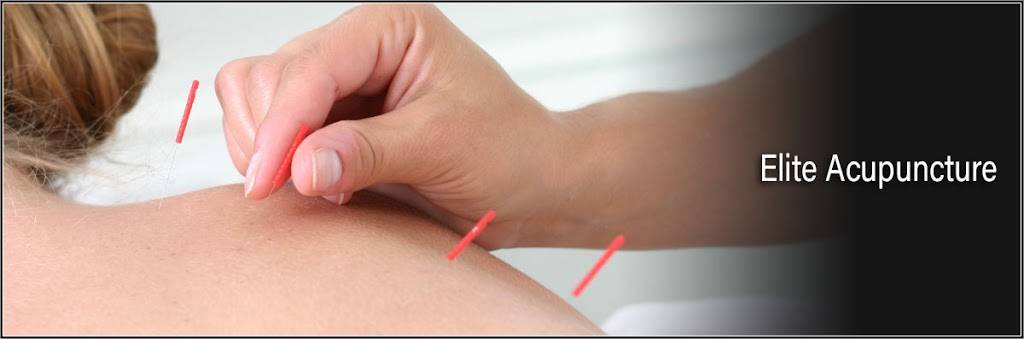 Elite Acupuncture | 3550 Bernal Ave #150, Pleasanton, CA 94566, USA | Phone: (925) 660-5535