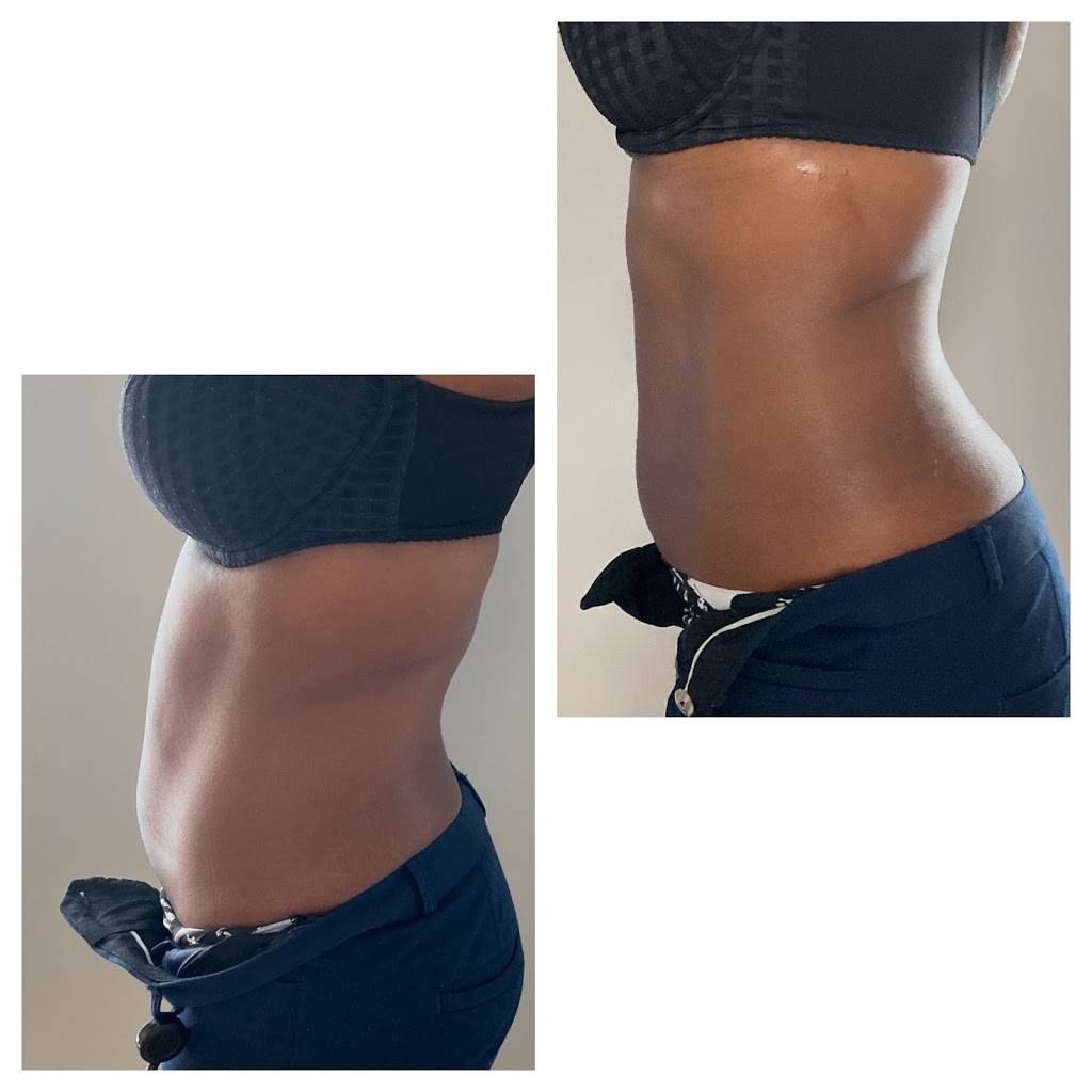 Body Goals Studio LLC | 1989 N Williamsburg Dr suite i, Decatur, GA 30033, USA | Phone: (404) 213-5300