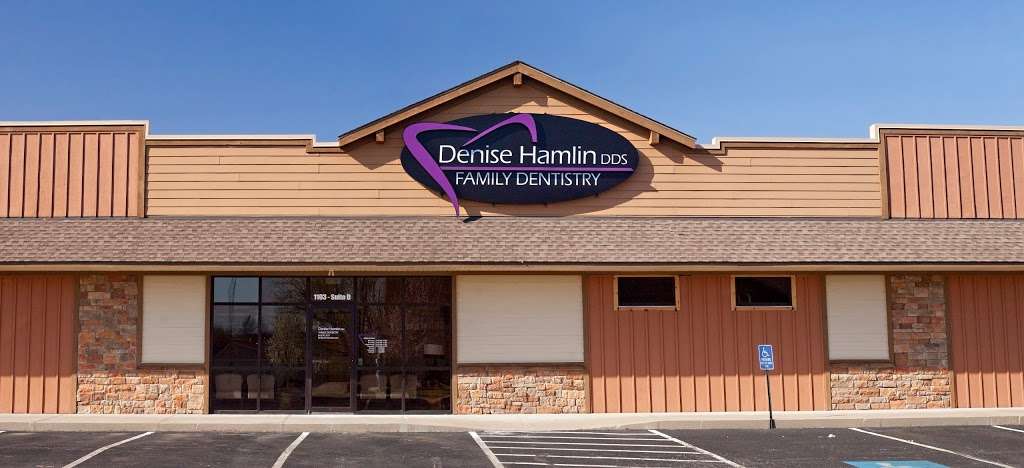 Denise Hamlin DDS | 1103 N Holden St #D, Warrensburg, MO 64093, USA | Phone: (660) 747-3171