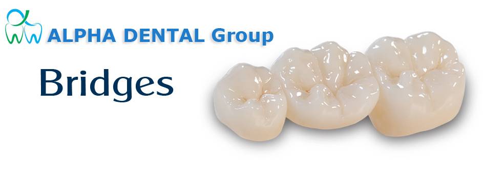 Alpha Dental Group 2 | 5870 SW 8th St Suite # 4, Miami, FL 33144 | Phone: (305) 392-1261