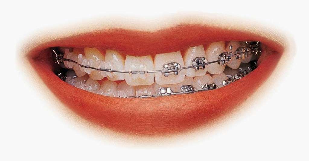 Chang DMD Orthodontics - Dr. Shiaw-Wei David Chang DMD | 7601 Lewinsville Rd #308, McLean, VA 22102, USA | Phone: (703) 506-8787