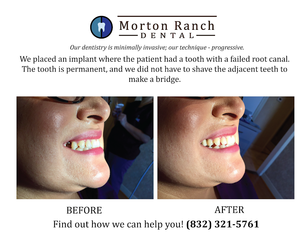 Morton Ranch Dental | 2922 N Mason Rd #140, Katy, TX 77449 | Phone: (832) 321-5761