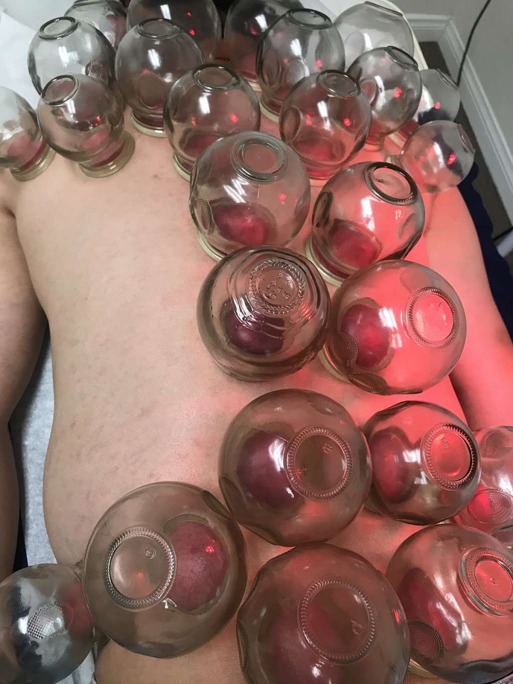 黎禧记中医针灸拔罐艾灸刮痧中药 Acupuncture cupping | 159 E LIVE OAK AVE, STE 107, ARCADIA, CA 91006, USA | Phone: (626) 205-8330