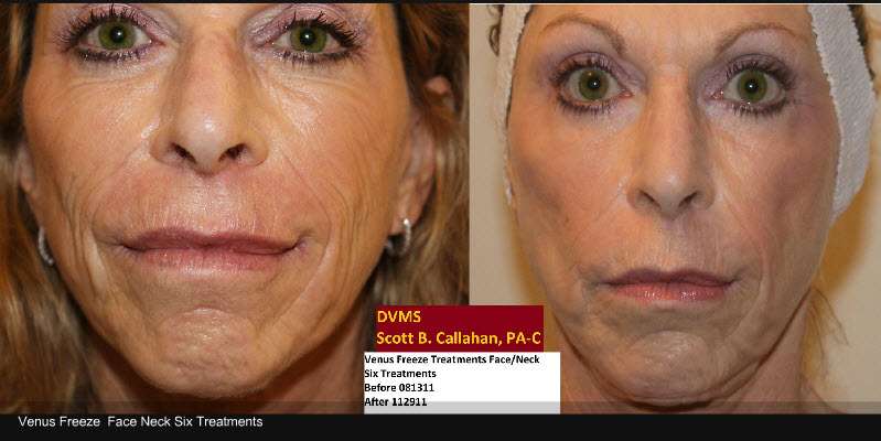 Island Plastic Surgery | 474 Montauk Hwy, West Islip, NY 11795, USA | Phone: (631) 661-2579