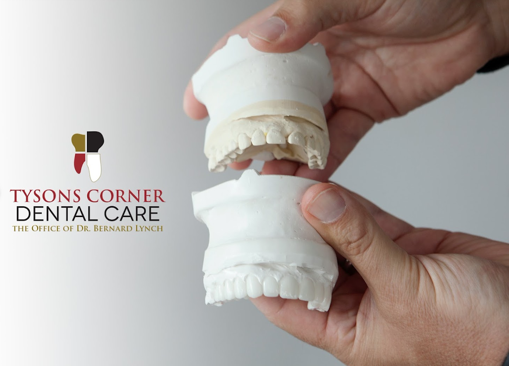 Tysons Corner Dental Care | 8363 B, Greensboro Dr, McLean, VA 22102, USA | Phone: (703) 457-8261