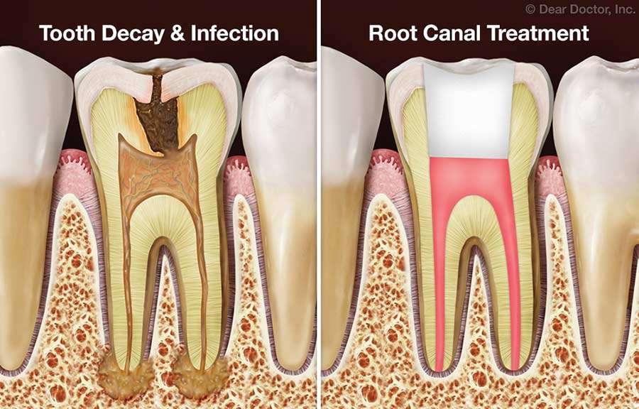 Kreative Dental Care | 120 Carter Blvd #7, Polk City, FL 33868, USA | Phone: (863) 984-0000