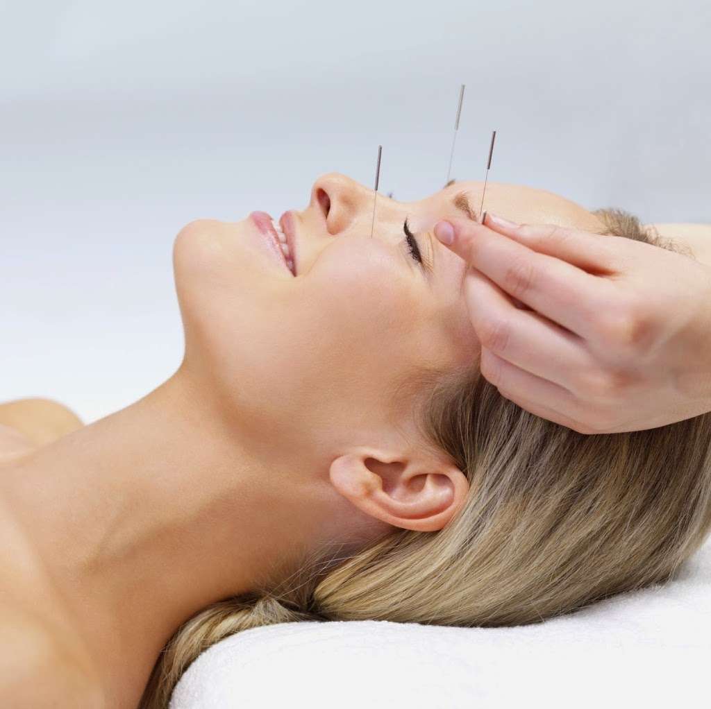 Chinese Acupuncture of Staten Island | 32 Beard Street, Side Entrance, Staten Island, NY 10314 | Phone: (718) 689-3737