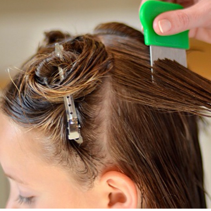 Help For Lice Indy | 1085 Fox Hill Dr, Indianapolis, IN 46228, USA | Phone: (317) 400-4864