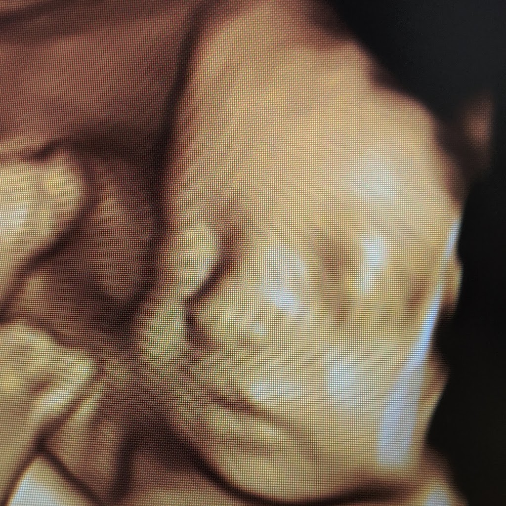 Sweet Baby Face HD 3D 4D 5D Ultrasound | 3422 Stony Spring Cir, Louisville, KY 40220, USA | Phone: (502) 509-1003