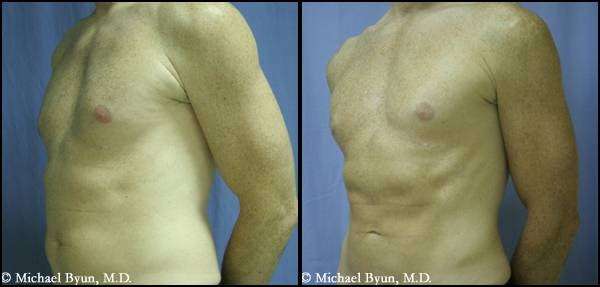 Chicago Cosmetic Surgery: Michael Byun M.D. | 1775 Walters Ave, Northbrook, IL 60062, USA | Phone: (847) 513-6899