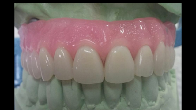 Oak Tree Denture Cosmetics Same Day Repairs!! For Dentist Only | 990 Raritan Rd, Clark, NJ 07066, USA | Phone: (732) 499-8244