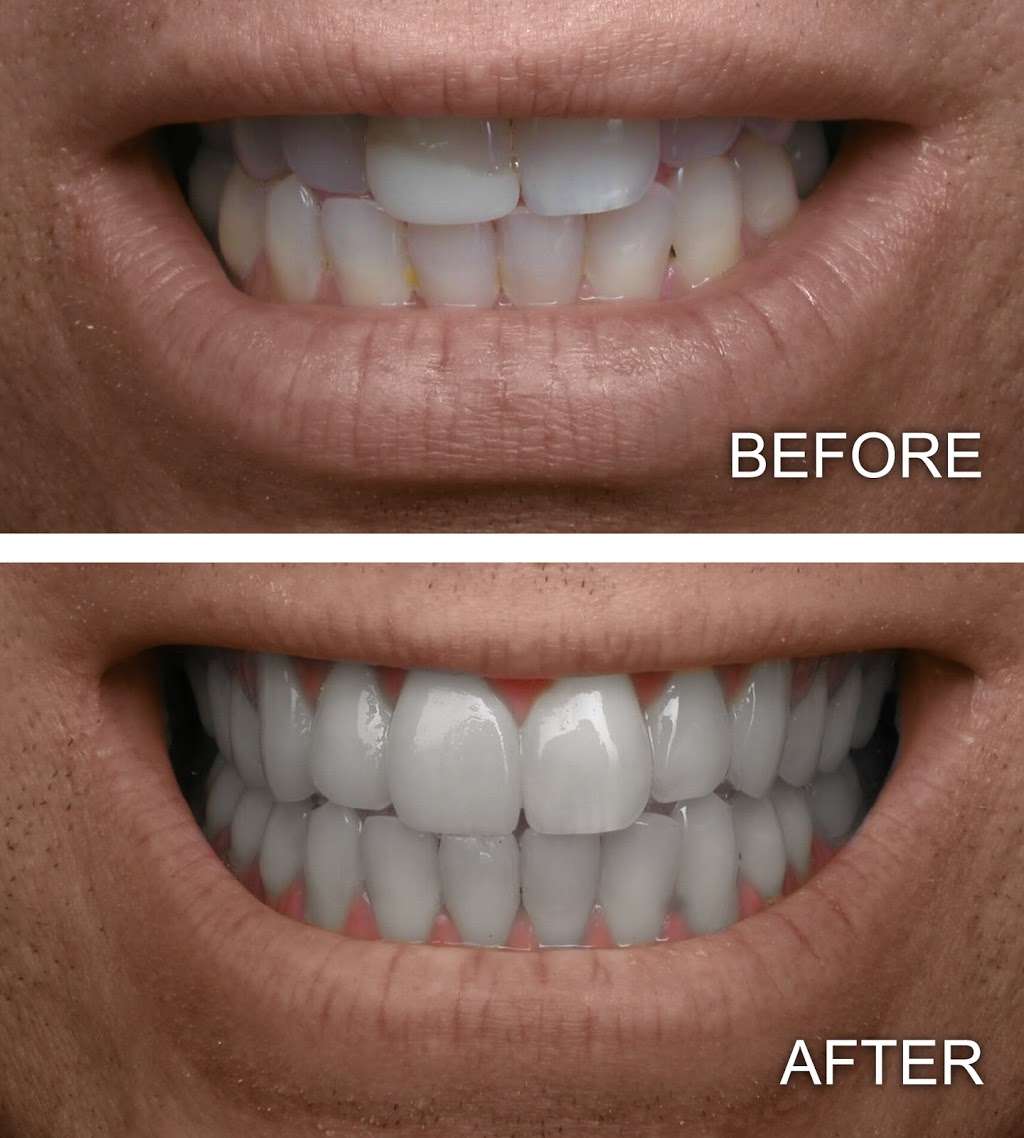 Star Smile Dental Center | 377 Union Ave, Framingham, MA 01702, USA | Phone: (508) 872-0045