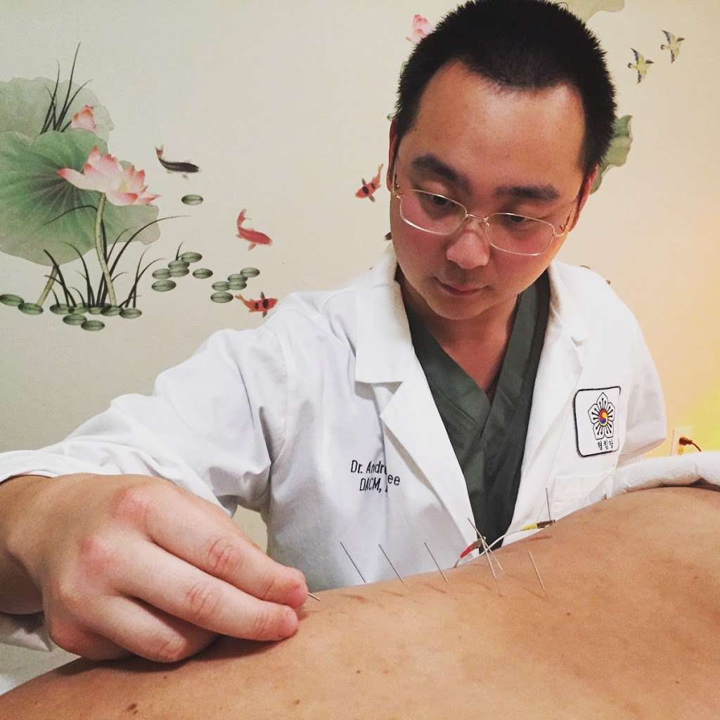 Lees Acupuncture | 3980 San Pablo Dam Rd #205, El Sobrante, CA 94803 | Phone: (510) 730-0340