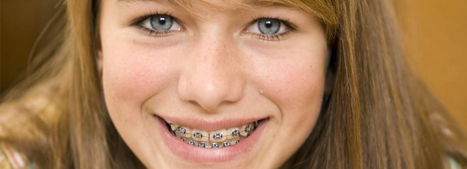 Park View Orthodontics of San Diego | 2918 Fifth Ave #310, San Diego, CA 92103, USA | Phone: (619) 295-2288