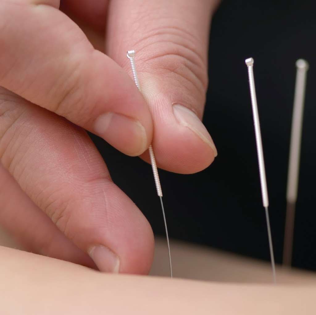 Point of Healing Acupuncture | 114 Water St # 2, Milford, MA 01757, USA | Phone: (774) 217-0414