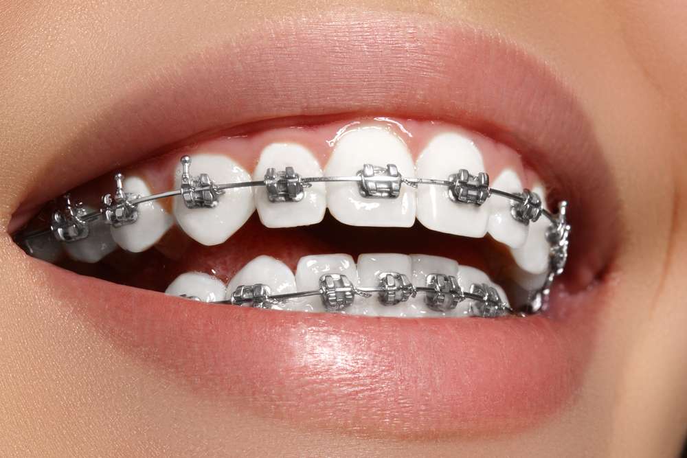 Cochran Orthodontics | 2246 SE Military Dr, San Antonio, TX 78223 | Phone: (210) 714-5525