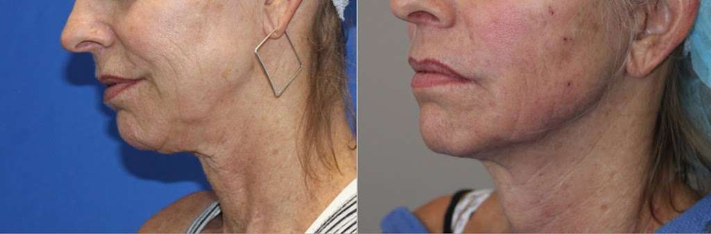 Vitality Institute Of Agoura: Michael Sarti, MD | 30200 Agoura Rd #110, Agoura Hills, CA 91301, USA | Phone: (818) 208-3593 Vitality Institute Of Agoura: Michael Sarti, MD | 30200 Agoura Rd #110, Agoura Hills, CA 91301, USA | Phone: (818) 208-3593